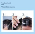 Electric Head Massage Comb  2437 - Image 7