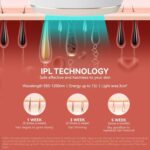 Mini IPL Hair Removal Device  2188N - Image 7